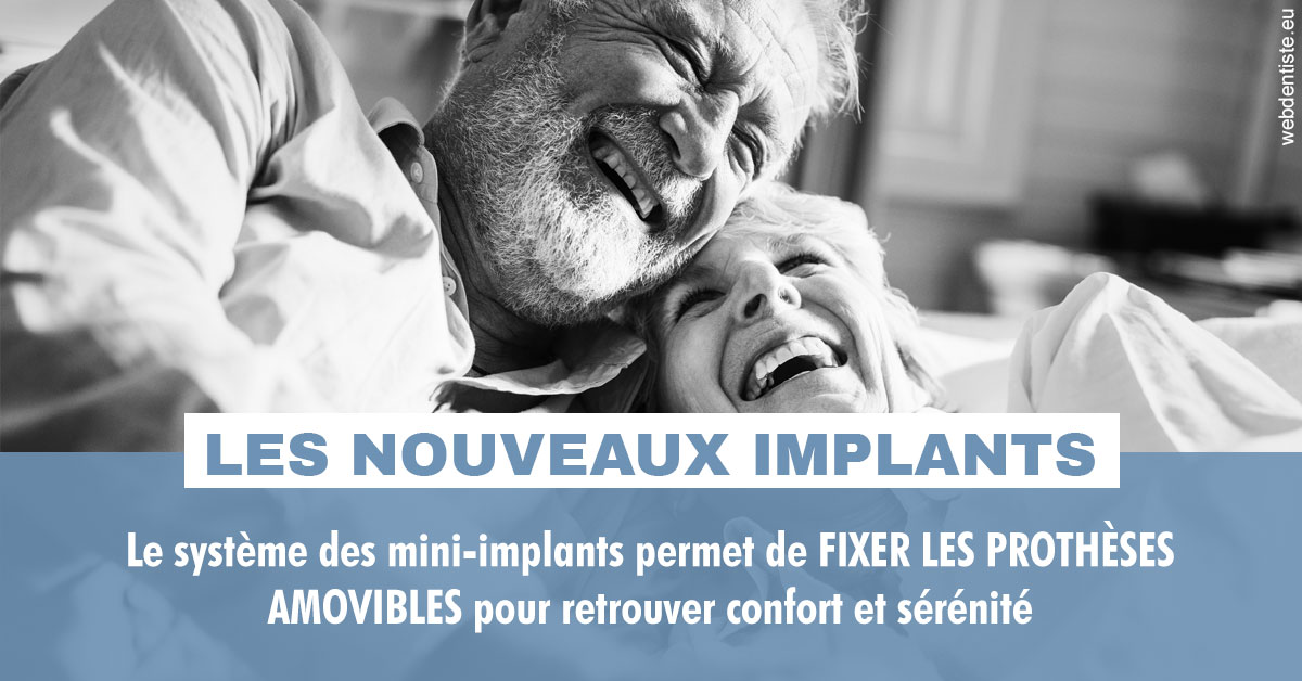 https://dr-minh-phan.chirurgiens-dentistes.fr/Les nouveaux implants 2