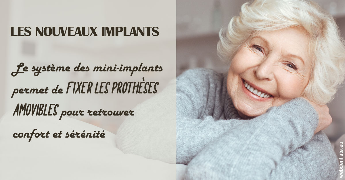 https://dr-minh-phan.chirurgiens-dentistes.fr/Les nouveaux implants 1