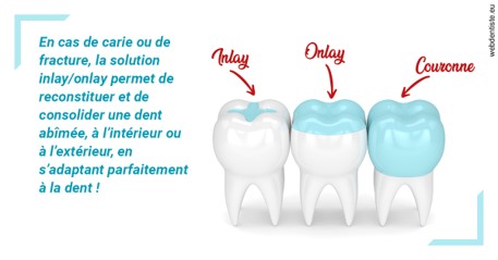 https://dr-minh-phan.chirurgiens-dentistes.fr/L'INLAY ou l'ONLAY