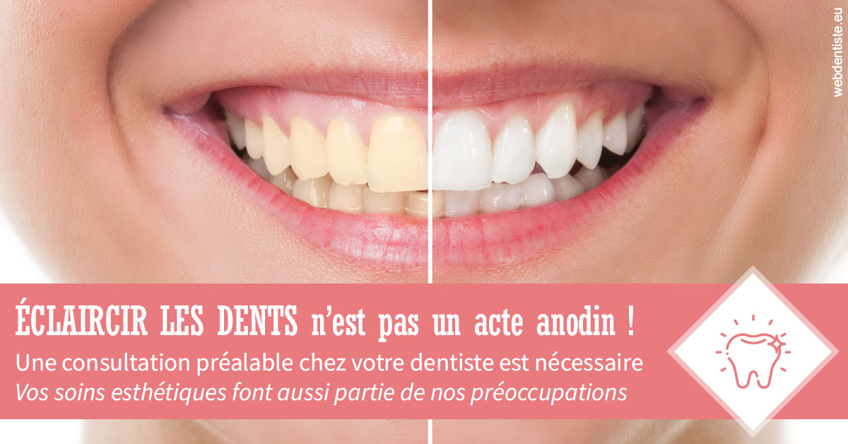 https://dr-minh-phan.chirurgiens-dentistes.fr/Eclaircir les dents 1