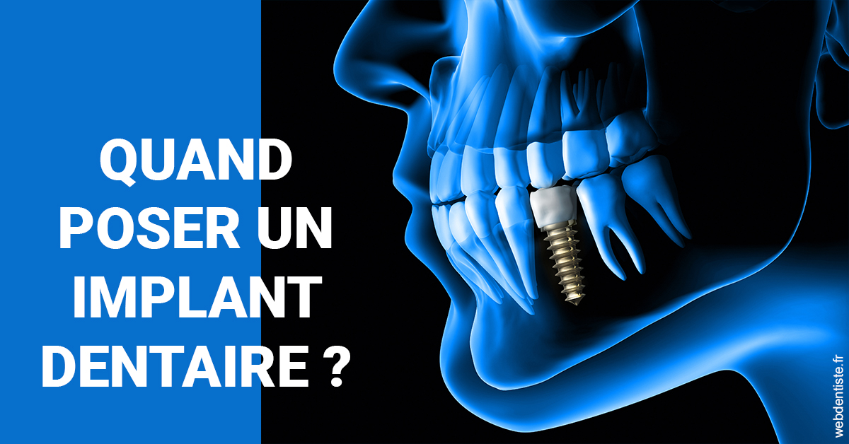 https://dr-minh-phan.chirurgiens-dentistes.fr/Les implants 1