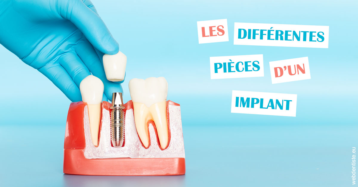 https://dr-minh-phan.chirurgiens-dentistes.fr/Les différentes pièces d’un implant 2