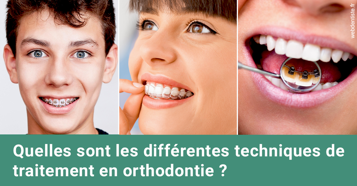https://dr-minh-phan.chirurgiens-dentistes.fr/Les différentes techniques de traitement 2