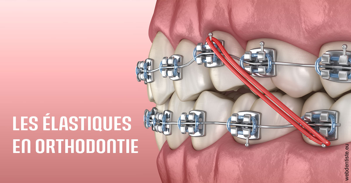 https://dr-minh-phan.chirurgiens-dentistes.fr/Elastiques orthodontie 2