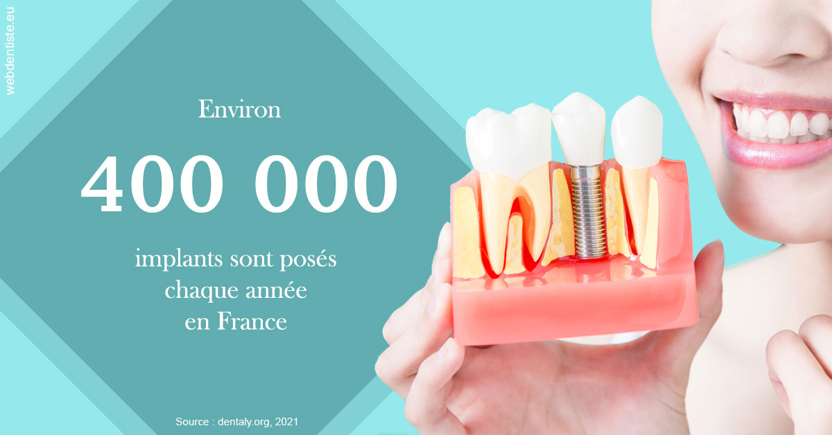 https://dr-minh-phan.chirurgiens-dentistes.fr/Pose d'implants en France 2