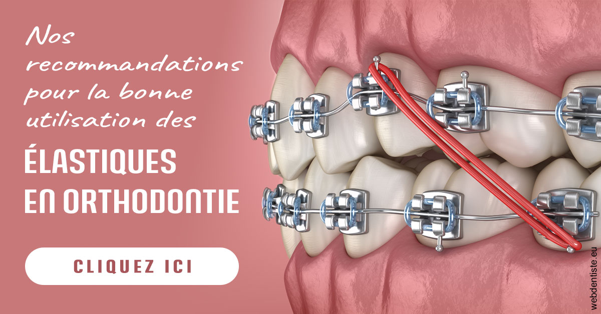 https://dr-minh-phan.chirurgiens-dentistes.fr/Elastiques orthodontie 2